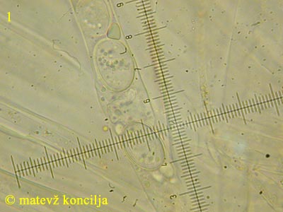 scutellinia scutellata - askospore