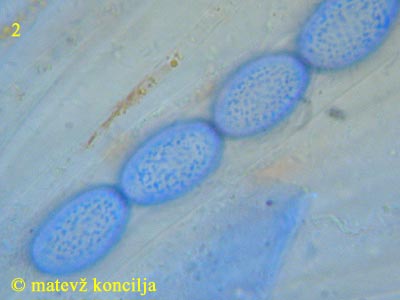 scutellinia scutellata - askospore