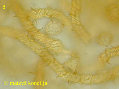 Hemitrichia serpula - Capillitium