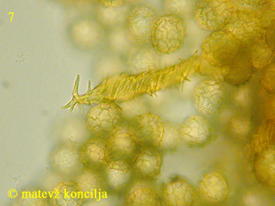Hemitrichia serpula - Capillitium