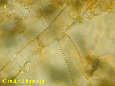 Hemitrichia serpula - Basalhyphen