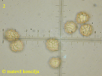 Hemitrichia serpula - Sporen