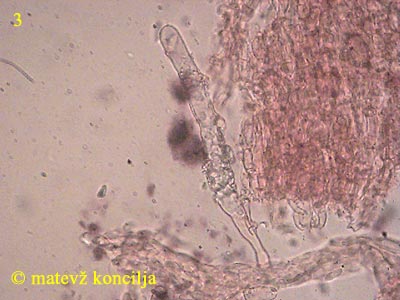 Hyphoderma setigerum - Septozystide
