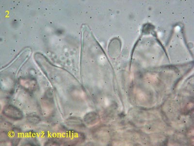 psathyrella spadicea - kajlocistide