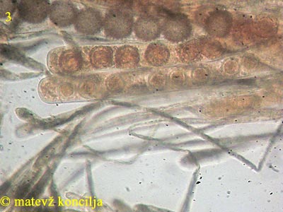 Scutellinia trechispora - Asci