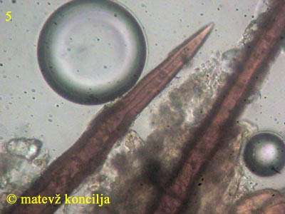 Scutellinia trechispora - Haare