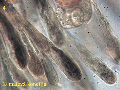 Scutellinia trechispora - Paraphysen