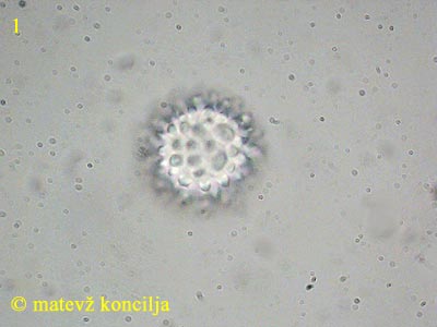 Scutellinia trechispora - Spore