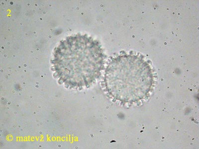 Scutellinia trechispora - Sporen