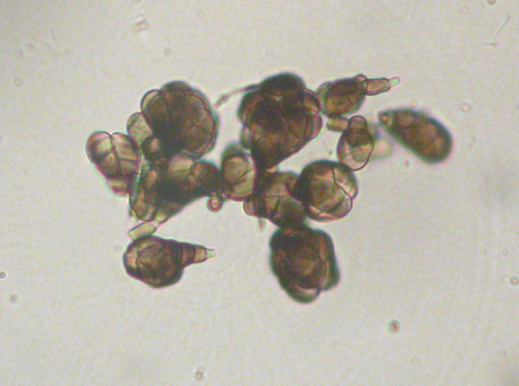 Trimmatostroma scutellare