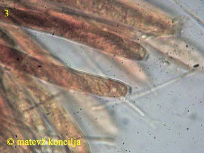 Phaeohelotium umbilicatum - Asci