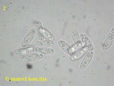 Phaeohelotium umbilicatum - Sporen
