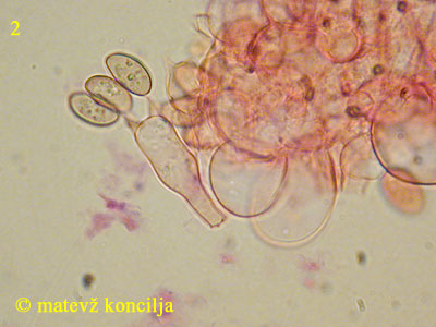 Coprinus velatopruinatus - Basidie