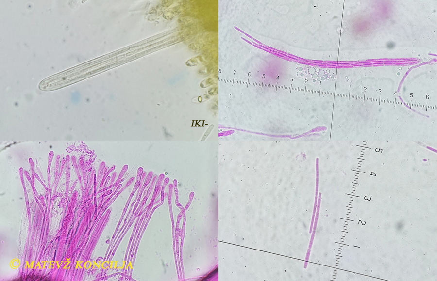 Vibrissea-flavovirens - Gelbrünes Kranzbecherchen