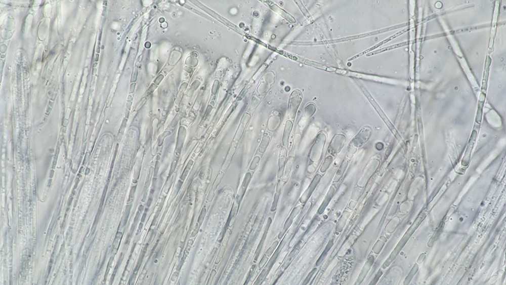 Vibrissea-flavovirens - Gelbrünes Kranzbecherchen