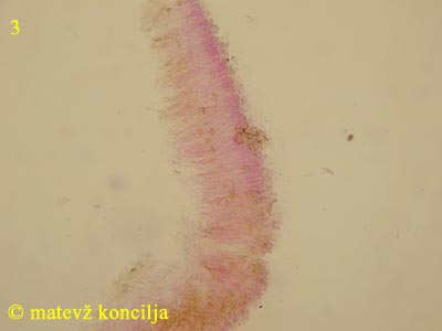 Clavulicium vinososcabens - Hymenium