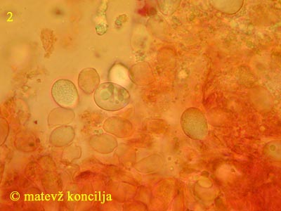 Clavulicium vinososcabens - Sporen