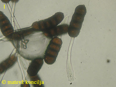 Phragmidium violaceum - teliospore