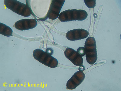 Phragmidium violaceum - teliospore