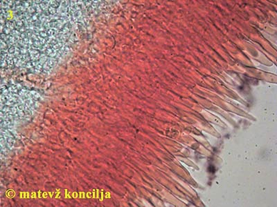 Russula violeipes - kajlocistide