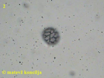 Russula violeipes - Spore