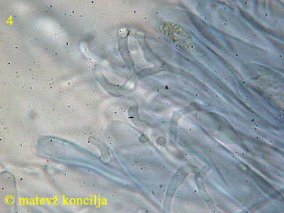 podophacidium xanthomelum - parafize