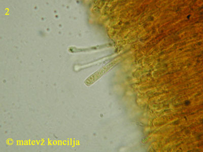 Orbilia xanthostigma - Ascus
