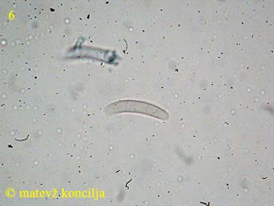 Dialonectria episphaeria - fremde Sporen