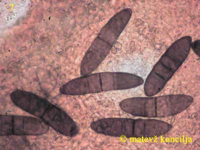Thyronectria coryli - fremde Sporen auf den Perithezien