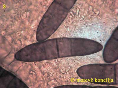 Thyronectria coryli - fremde Sporen auf den Perithezien