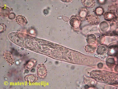 Russula aeruginea - Cheilozystide
