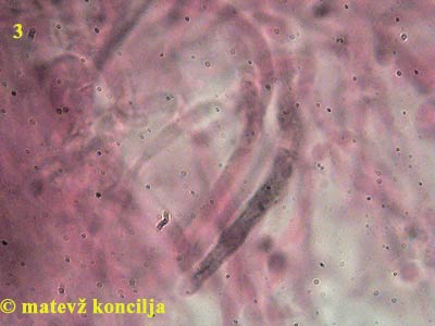 Russula aeruginea - Pileozystiden