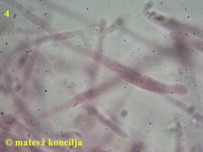 russula aeruginea - pileocistide