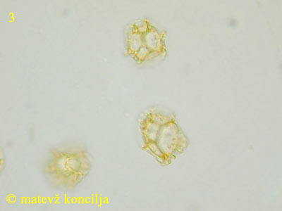 Trichia affinis - Sporen