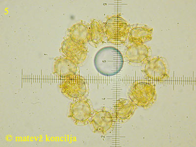 Trichia affinis - Sporen