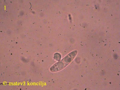 Hymenoscyphus albidus - Spore