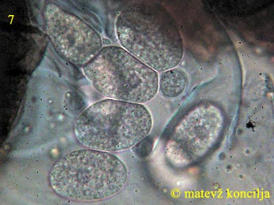 Erysiphe alphitoides - askospore