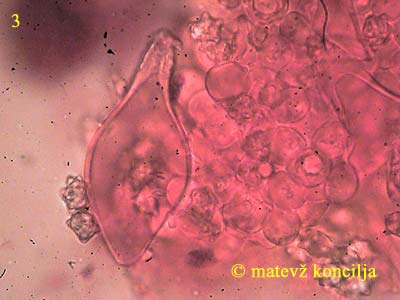 inocybe asterospora - kajlocistide