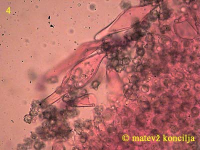 inocybe asterospora - kajlocistide