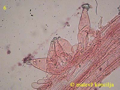 inocybe asterospora - kaulocistide