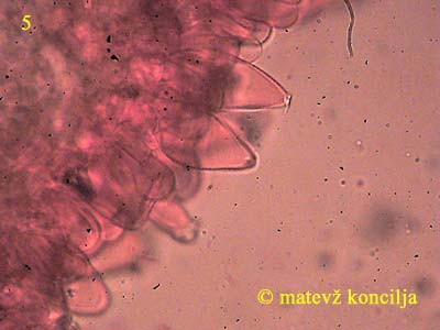 inocybe asterospora - pleurocistide