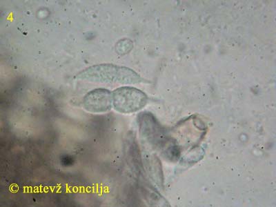 Hypomyces aurantius - Sporen