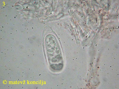 Sarcoscypha austriaca - Sporen