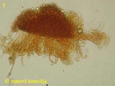 Sawadaea bicornis - appendices
