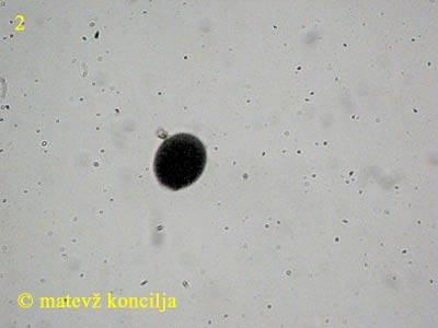 Biscogniauxia nummularia - Sporen