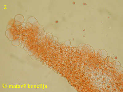 Coprinellus bisporus - kajlocistide
