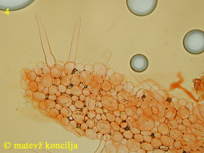 Coprinellus bisporus - pileocistide