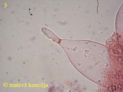Volvariella caesiotincta - Cheilozystiden