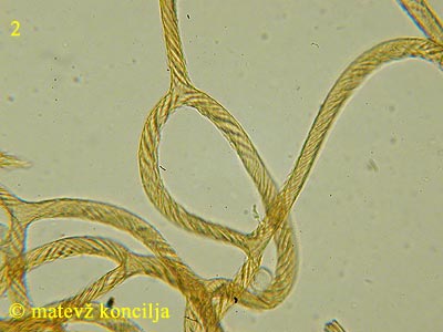 Hemitrichia calyculata - capillitium