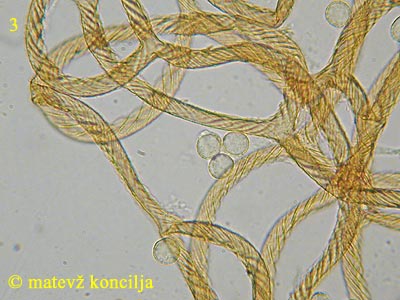Hemitrichia calyculata - capillitium